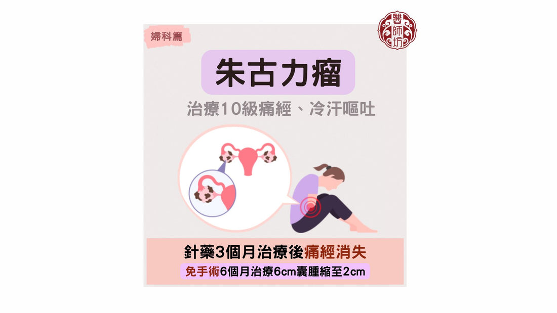 【朱古力瘤病案分享:治療10級痛經，伴冷汗嘔吐】